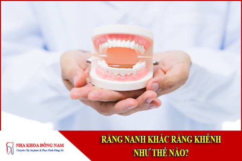 Răng nanh và răng khểnh khác nhau như thế nào