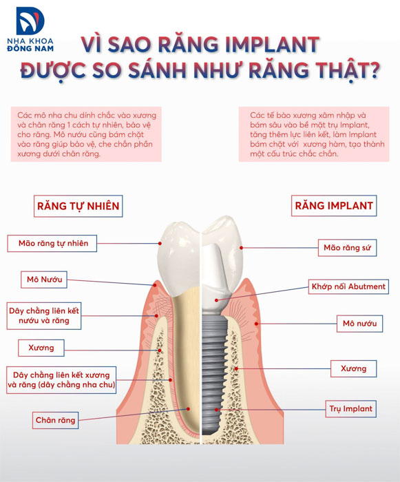 Trồng răng Implant giúp phục hình răng một cách tốt nhất