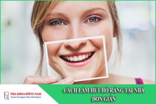 Cách làm răng hết hô tại nhà đơn giản