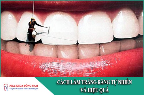 5 Cách làm răng trắng tự nhiên và hiệu quả