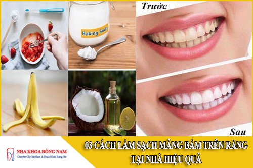 3 Cách làm sạch mảng bám trên răng tại nhà