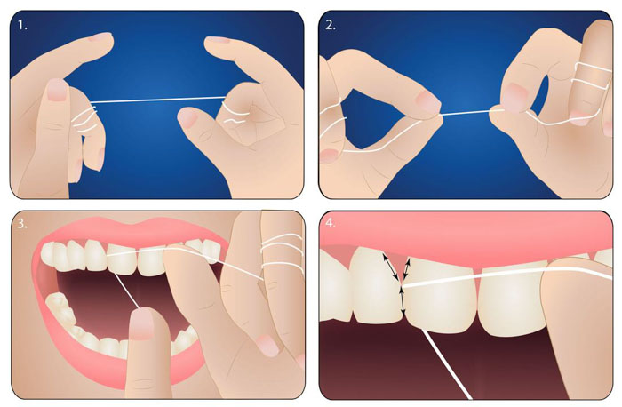 Dùng chỉ nha khoa để làm sạch kẽ răng mỗi ngày