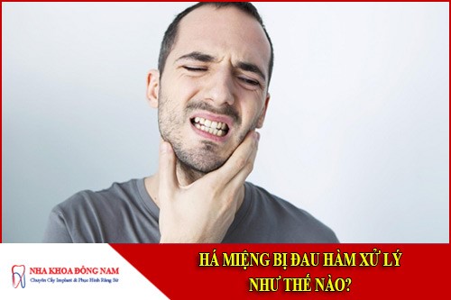 Há miệng bị đau hàm xử lý như thế nào?