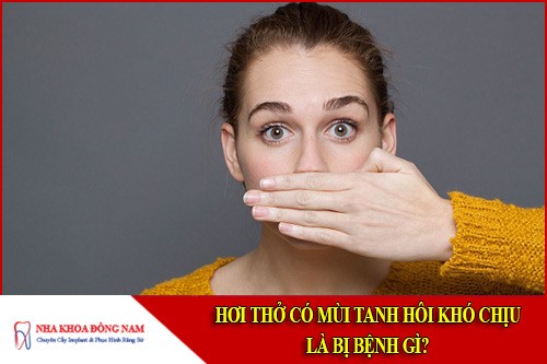 Hơi thở có mùi tanh hôi khó chịu là bị bệnh gì?