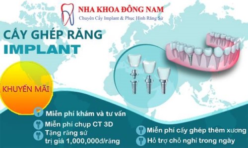 chính sách ưu đãi tại nha khoa đông nam