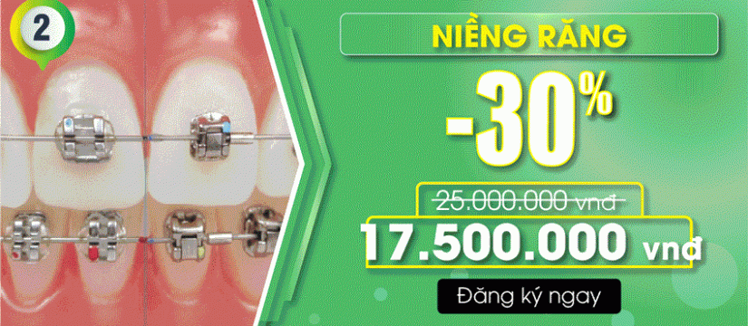 Khuyến mãi niềng răng nhân dịp quốc khánh 2/9/2019