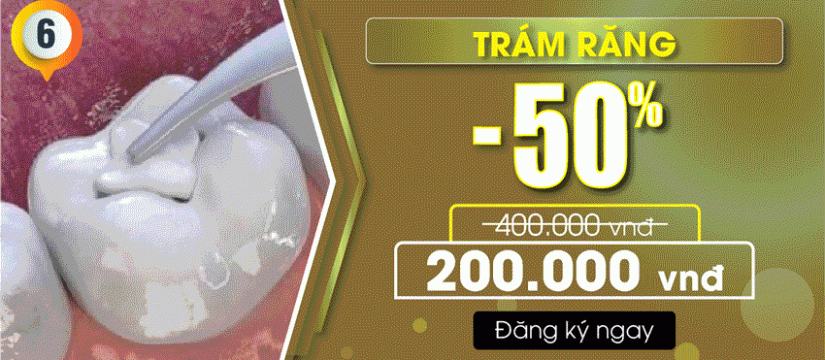 Khuyến mãi trám răng thẩm mỹ nhân dịp quốc khánh 2/9/2019