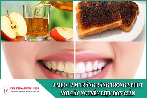 3 Mẹo làm trắng răng trong 5 phút với các nguyên liệu đơn giản