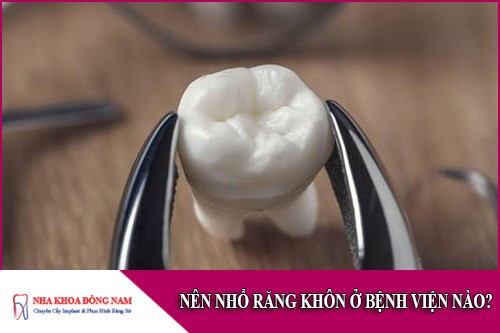 Nên nhổ răng khôn ở bệnh viện nào?