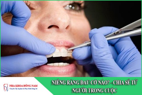 Niềng răng đau cỡ nào? ~ Chia sẻ từ người trong cuộc