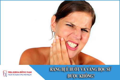 Răng bị ê buốt và vàng bọc sứ được không?