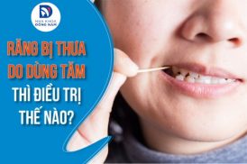 Răng bị thưa do dùng tăm thì điều trị thế nào?