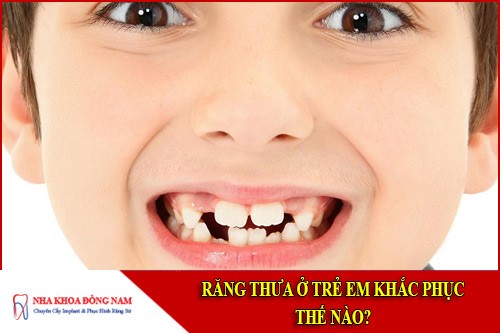 Răng thưa ở trẻ em khắc phục thế nào?