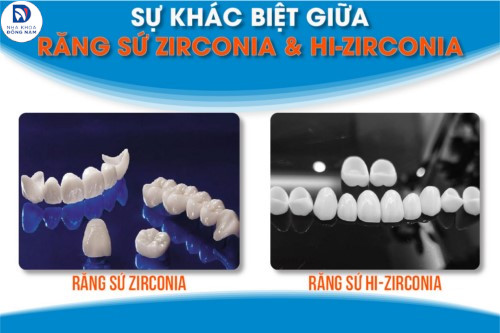 So sánh răng sứ Zirconia và Hi-Zirconia