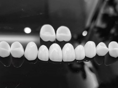 răng sứ Zirconia