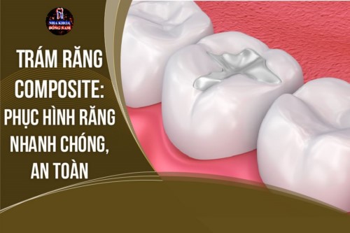 Trám răng Composite là gì? Có ảnh hưởng gì không?