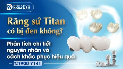 Răng sứ Titan có bị đen không? Phân tích chi tiết nguyên nhân và cách khắc phục hiệu quả