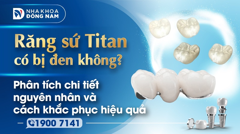 Răng sứ Titan có bị đen không? Phân tích chi tiết nguyên nhân và cách khắc phục hiệu quả