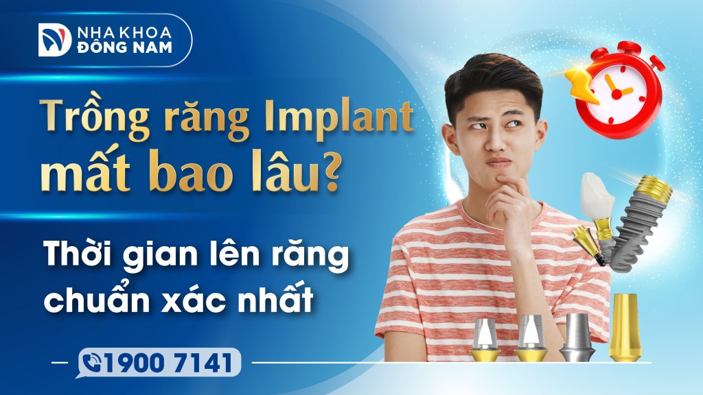 Trồng răng Implant mất bao lâu tại Nha khoa Đông Nam?