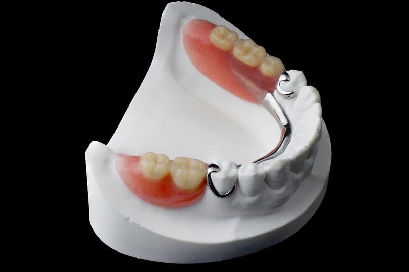 Răng giả tháo lắp cho răng số 6 chỉ đảm bảo ăn nhai ở mức cơ bản