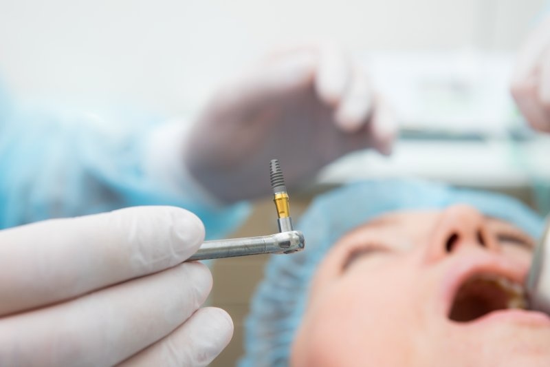 Thời gian cụ thể trồng Implant qua từng giai đoạn