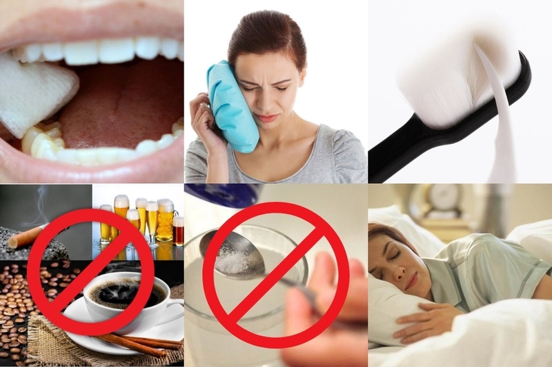 Chăm sóc sau khi nhổ răng khôn