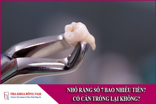 Nhổ răng số 7 bao nhiêu tiền? Có cần trồng lại không?