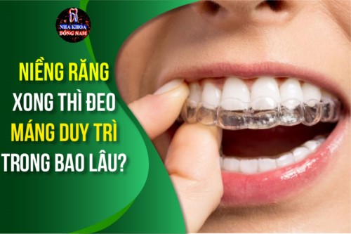 Niềng răng xong thì đeo máng duy trì trong bao lâu?