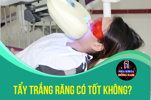 tẩy trắng răng có tốt không