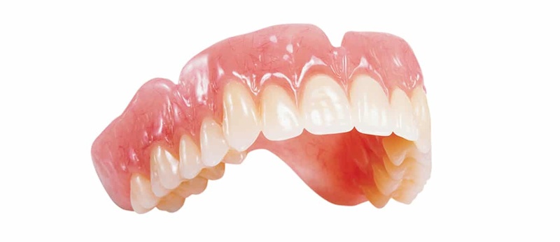 Hàm tháo lắp phục hình răng mất truyền thống