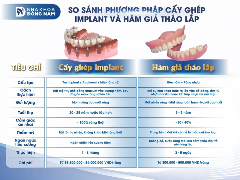 So sánh phương pháp cấy ghép Implant và răng giả tháo lắp