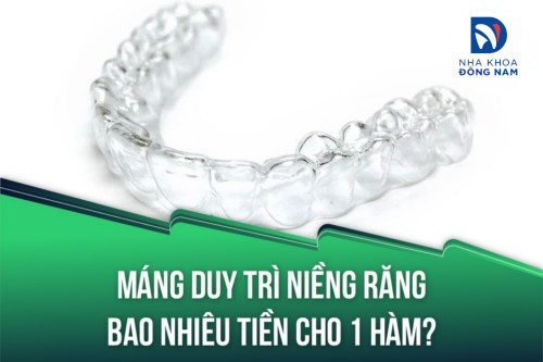 Máng duy trì niềng răng bao nhiêu tiền cho 1 hàm?