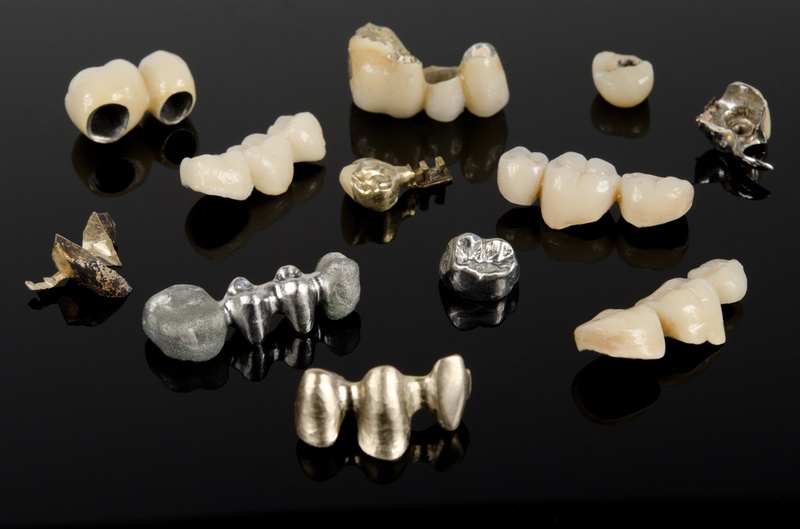 Răng sứ kim loại là dòng răng sứ phổ biến trên thị trường