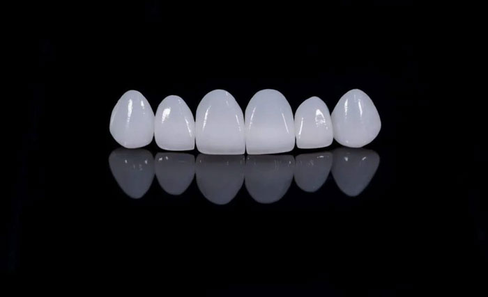 Răng sứ Zirconia Katana có thẩm mỹ vượt trội