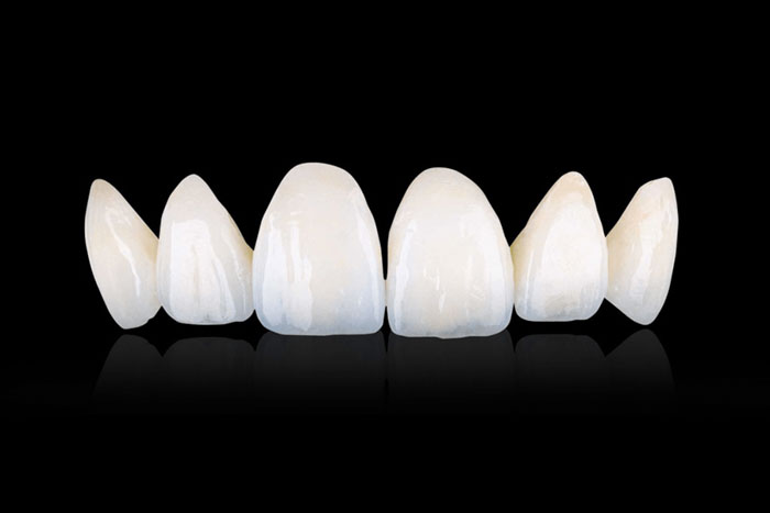 Răng sứ Zirconia toàn khối cho độ bền chắc cao