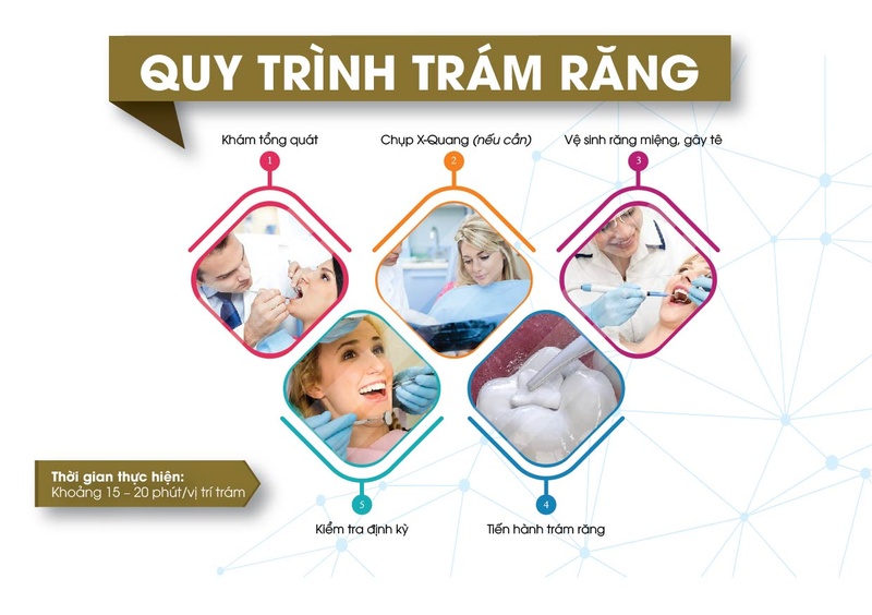 Quy trình trám răng tại Nha Khoa Đông Nam