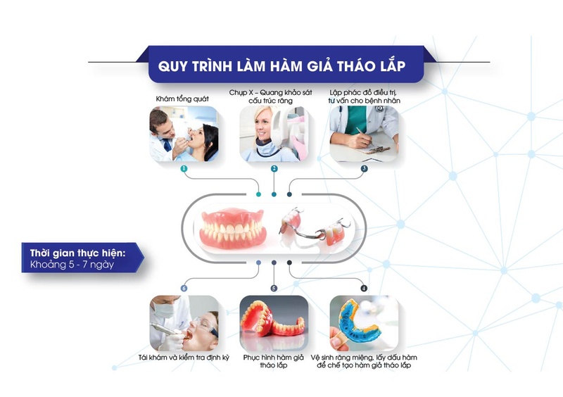 Quy trình làm răng giả tháo lắp