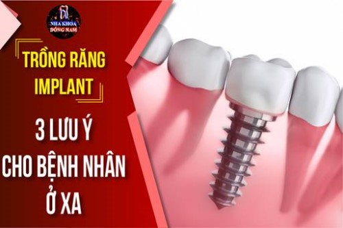 Lưu ý trồng răng Implant cho bệnh nhân ở xa