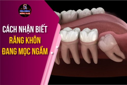 Cách nhận biết răng khôn đang mọc ngầm