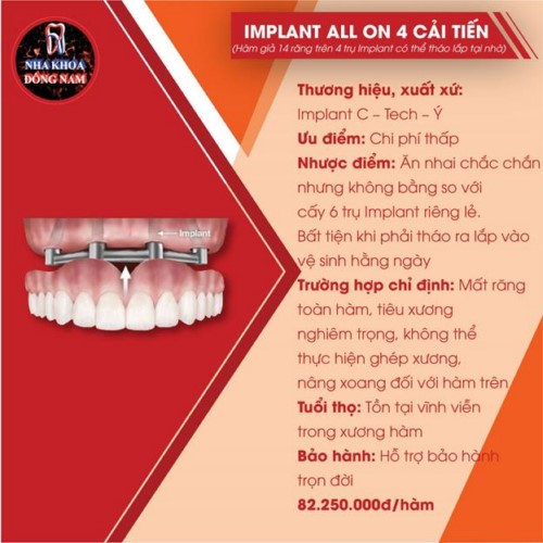 Trồng răng nguyên hàm với Implant all on 4 cải tiến 3