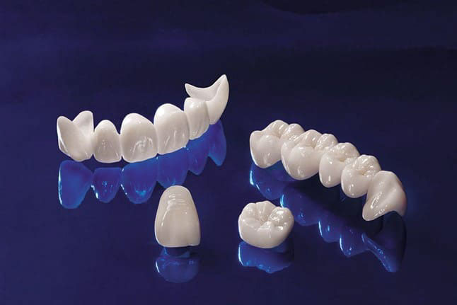 Dùng răng sứ toàn sứ để tránh tối đa tình trạng đen chân răng