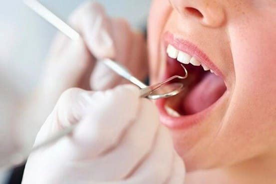 Lấy vôi răng và thăm khám nha khoa định kỳ