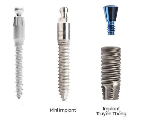 Mini Implant thường có đường kính trong nhỏ hơn so với Implant truyền thống