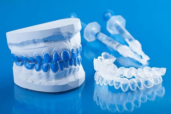 Dùng máng tẩy trắng răng được thiết kế theo dấu hàm tại nha khoa