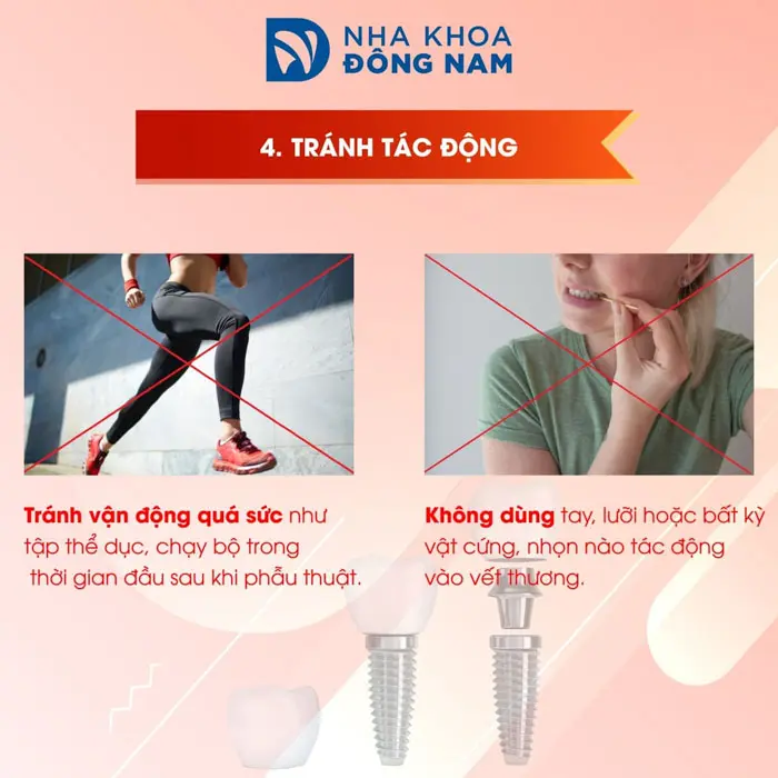 lưu ý 4 tránh tác động mạnh