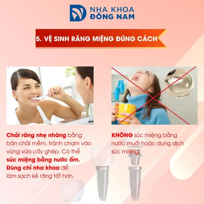 lưu ý 5 vệ sinh răng miệng đúng cách