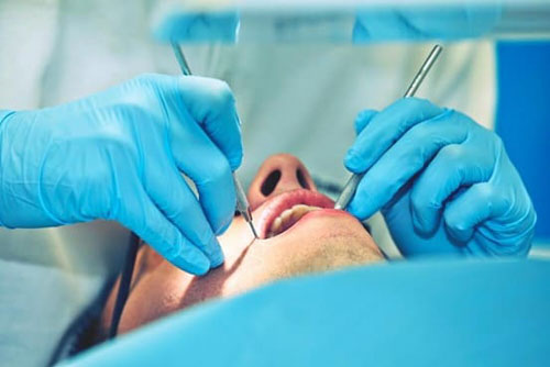 Phẫu thuật cắt chóp răng