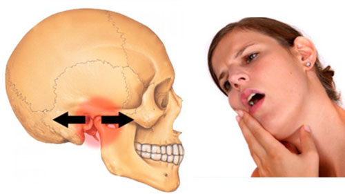 Đau xương hàm gần tai cảnh báo bệnh gì?