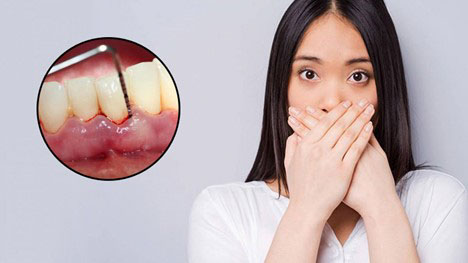 Răng bị đen mặt trong có ảnh hưởng tới sức khỏe không?