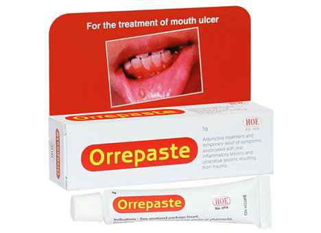 Thuốc nhiệt miệng Orrepaste